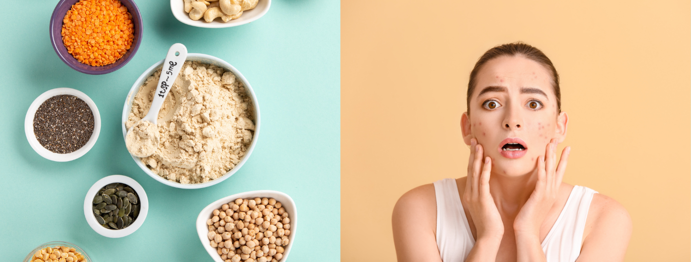 does protein powder cause acne